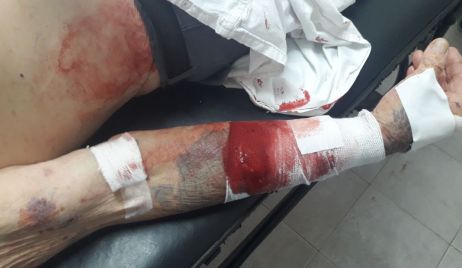 Ingresaron a robar y agredieron brutalmente a un abuelo.