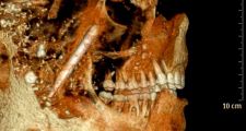 Descubren el secreto de las dentaduras perfectas de los antiguos romanos
