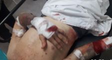 Ingresaron a robar y agredieron brutalmente a un abuelo.